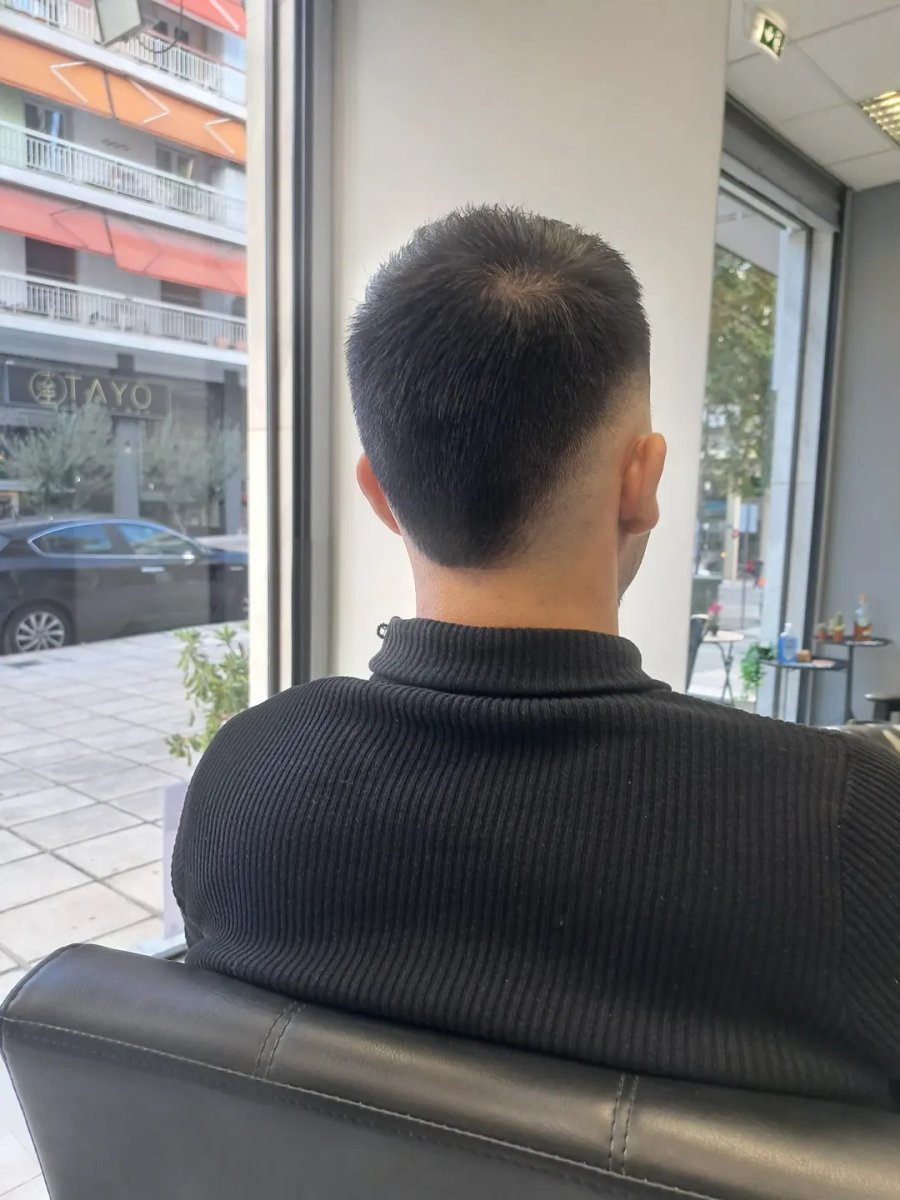 Σκίν φέιντ με καθαρή γραμμή, πίσω όψη